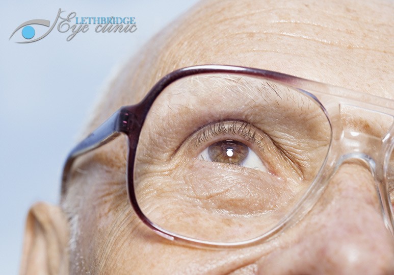 Age Related Macular Degeneration Lethbridge