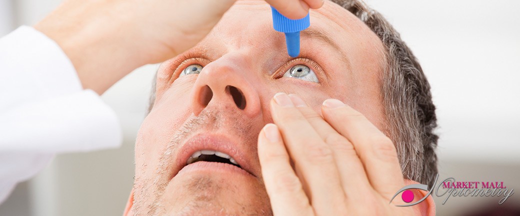 Dry Eye Care Lethbridge